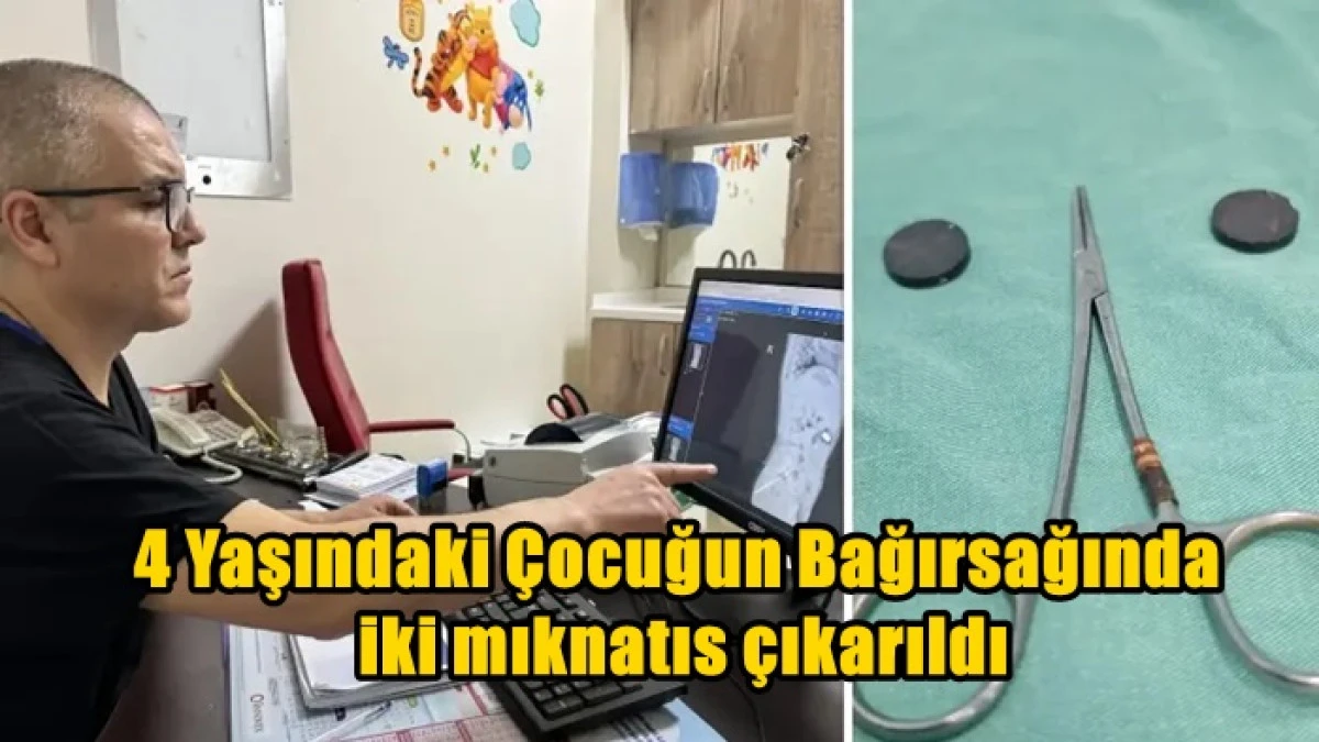 Tuvaletini yapamayan &ccedil;ocuğun bağırsağından iki mıknatıs &ccedil;ıkarıldı